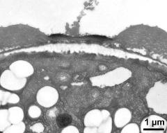 apertural area of pollen wall