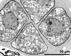  4 microspores enclosed by callose