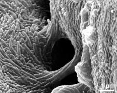 exine bridges between adjacent pollen grains of one tetrad