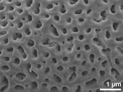 acetolyzed pollen,exine surface