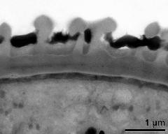 interapertural area of pollen wall