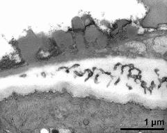 pollen wall at transition of aperture and interapertural area