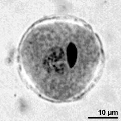 generative cell (right) and vegetative nucleus