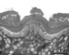 apertural area of pollen wall