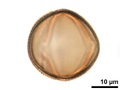 acetolyzed pollen,equatorial view