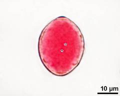 pollen grain with two sperm cells (asterisks)