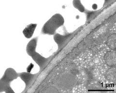 pollen wall; interapertural area