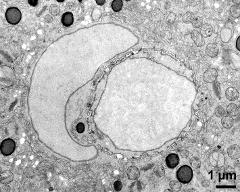 vegetative nucleus (left) and generative cell (right)
