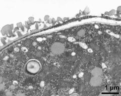 pollen wall at transition of aperture and interapertural area