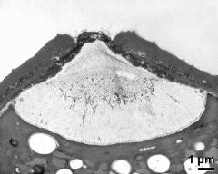 apertural area of pollen wall