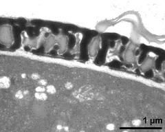 interapertural area of pollen wall