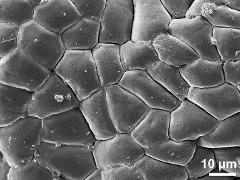 tetrads (forming pollinium)