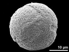 oblique polar view,tricolporate pollen grain