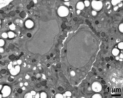 vegetative nucleus (left) and generative cell (right)