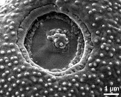 aperture of dry pollen grain