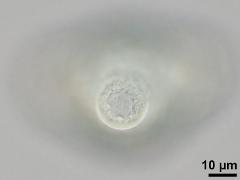 hydrated pollen,equatorial view,aperture
