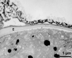 interapertural area of pollen wall, intine (I), endexine (E)