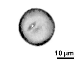 pollen grain with generative cell (asterisk) and vegetative nucleus