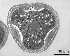 pollen grain in cross section