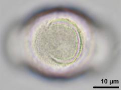 hydrated pollen,equatorial view