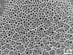 exine surface