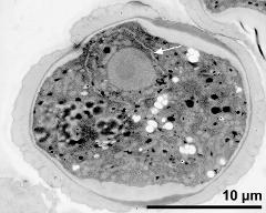 pollen grain in cross section with generative cell (arrow)