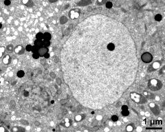 cytoplasma with generative cell (left) and vegetative nucleus (right), lipids