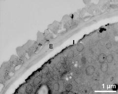 interapertural area of pollen wall, intine (I), endexine (E)