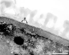 interapertural area of pollen wall