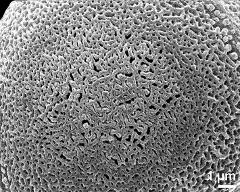 exine surface in interapertural area with ring-like wall thickening