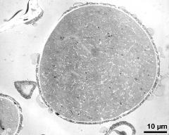 pollen grain in cross section