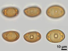 acetolyzed pollen,equatorial view