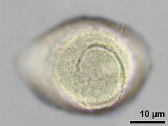 hydrated pollen,equatorial view