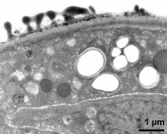 pollen wall at transition of aperture and interapertural area