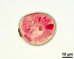 pollen grain with vegetative cell and two sperm cells