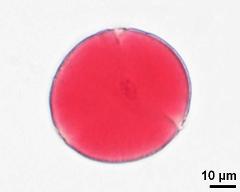 pollen grain with generative cell and vegetative nucleus