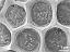 exine surface