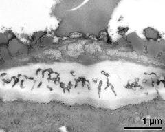 apertural area of pollen wall