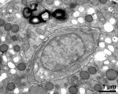 generative cell, starch and lipids