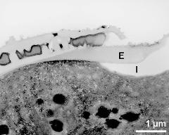 pollen wall at transition of aperture and interapertural area
