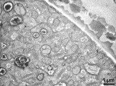 pollen wall and vegetative cytoplasm