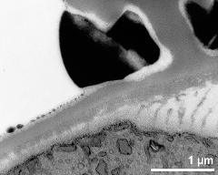 pollen wall, transition from aperture to interapertural area