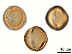 acetolyzed pollen,equatorial view