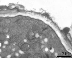 apertural area of pollen wall