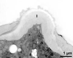 apertural area of pollen wall, intine (I)