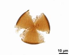 acetolyzed pollen, upper focus