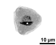 pollen grain with generative cell (asterisk) and vegetative nucleus