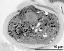 pollen grain in cross section with generative cell (arrow)