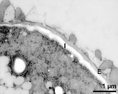 apertural area of pollen wall, intine (I), endexine (E)