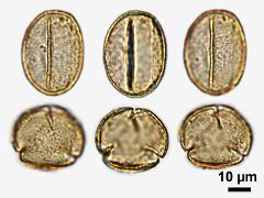 acetolyzed pollen,equatorial view,polar view